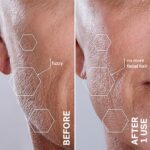 Michael Todd Beauty Sonicsmooth Dermaplane Razor for Women Face + Eyebrow trimmer Dermaplaning System – Peach Fuzz Remover – 8 Weeks of Dermaplaning Blades - Image 5